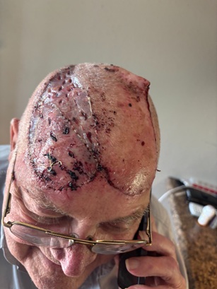 Dads head.jpg